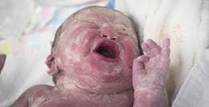 Адаптационни прояви у новородените